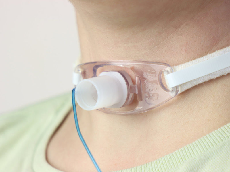 A patient with tracheostomy